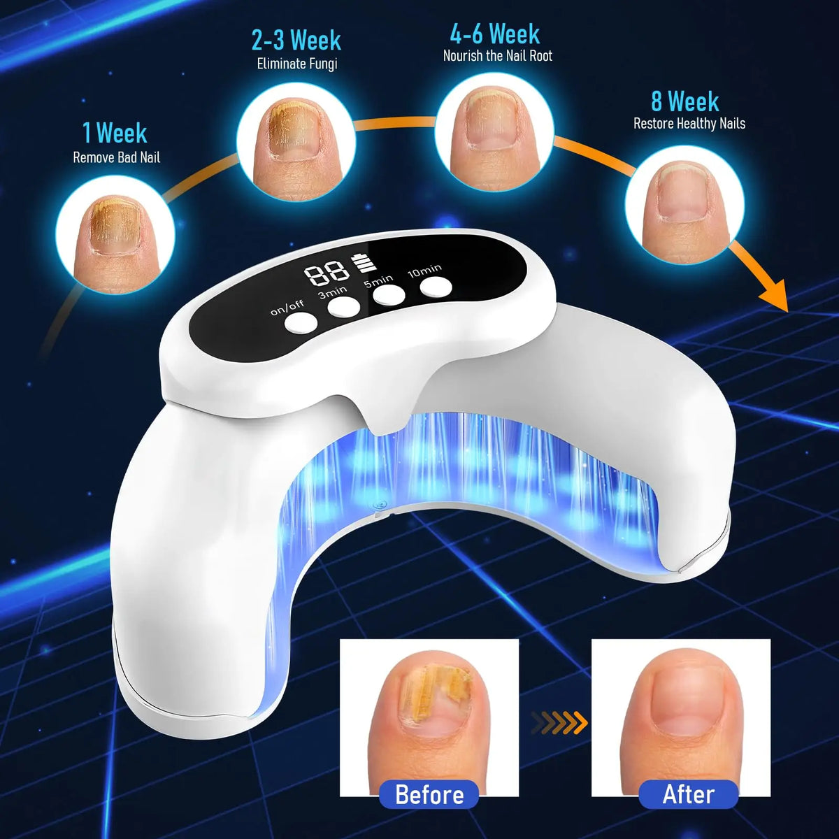 LED Nail Fungus Treatment Device (45W)