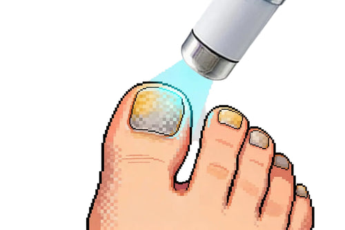 5th-Gen Champagne Nail Laser Pen