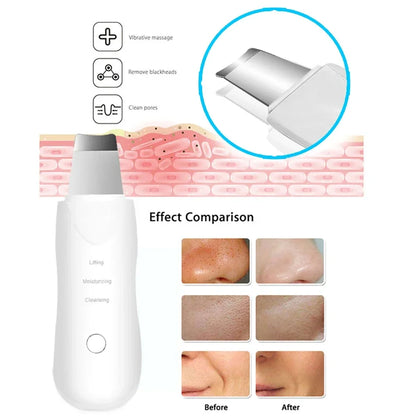 Professional Ultrasonic Facial Skin Scrubber - Ion Deep Cleansing Device