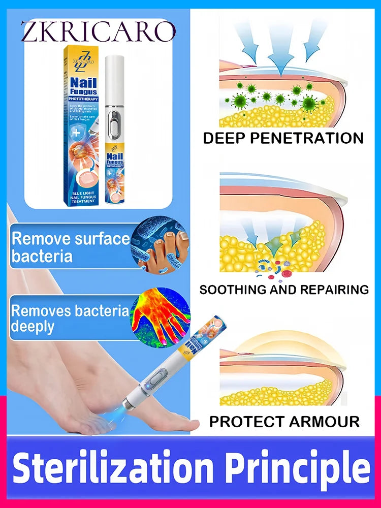 5th-Gen Champagne Nail Laser Pen